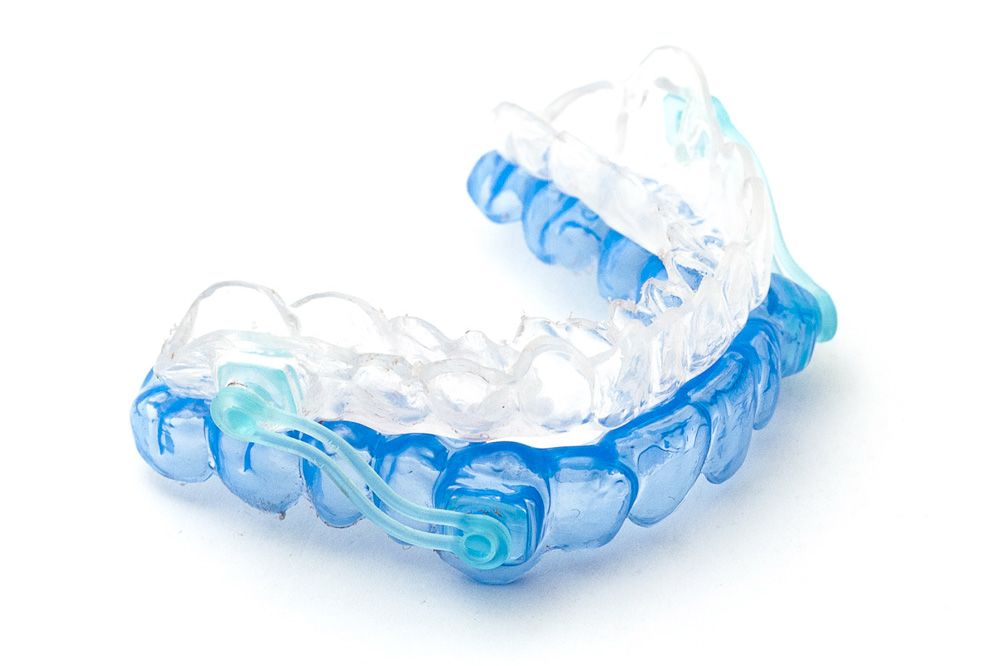sleep apnea oral appliance
