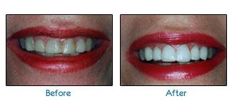 Before and after dental patient pictures
