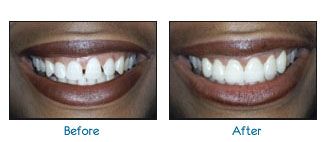 Before and after dental patient pictures
