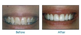 Before and after dental patient pictures