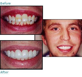 Before and after dental patient pictures