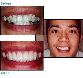 Before and after dental patient pictures
